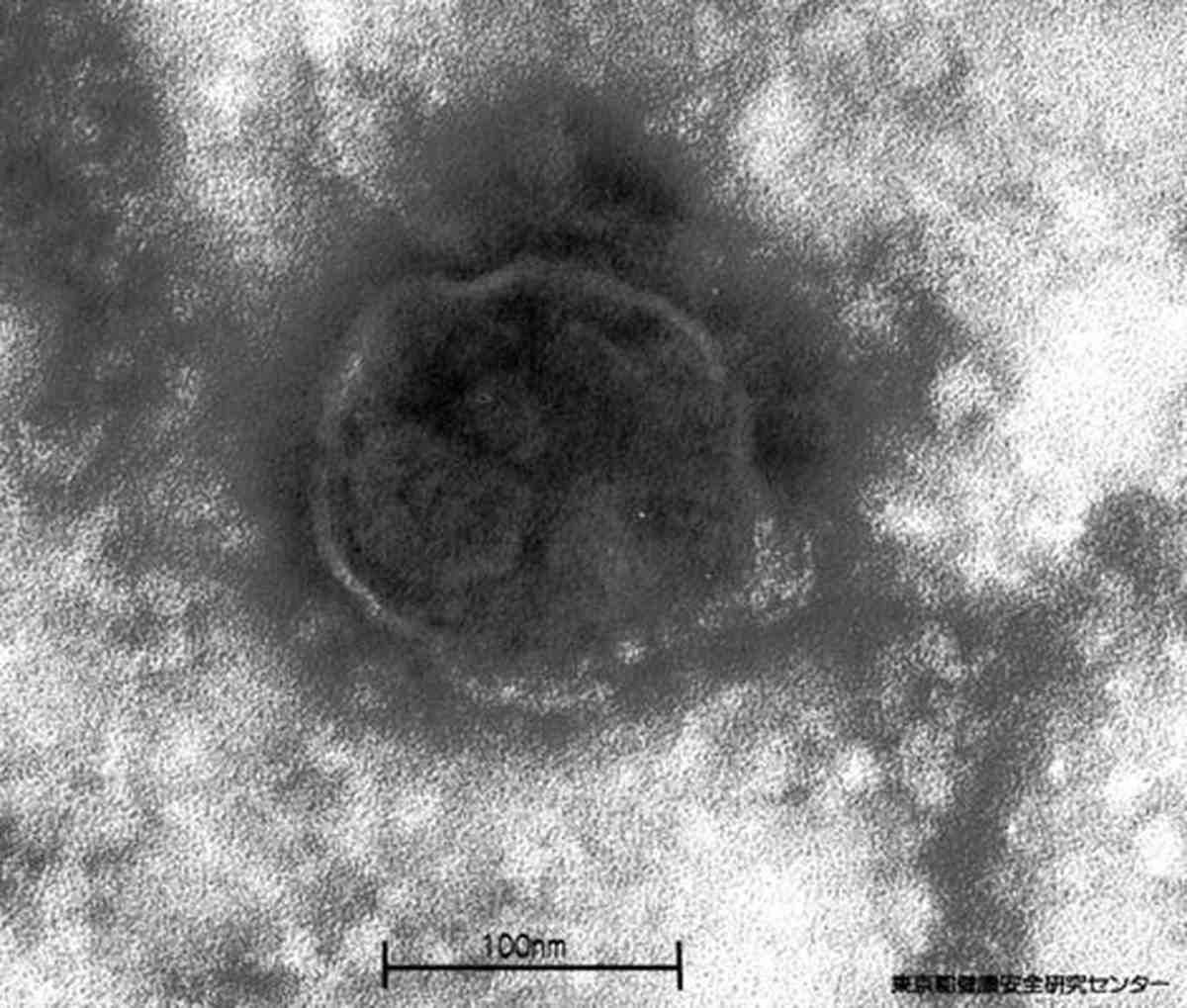 Measles Virus Provided by the Tokyo Metropolitan Institute of Public Health
